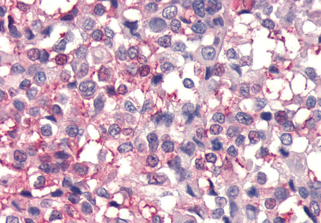 FZD4 Antibody in Immunohistochemistry (Paraffin) (IHC (P))