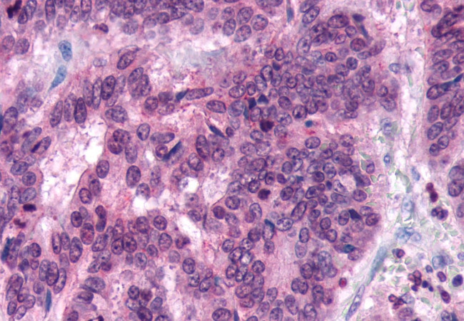 FZD5 Antibody in Immunohistochemistry (Paraffin) (IHC (P))