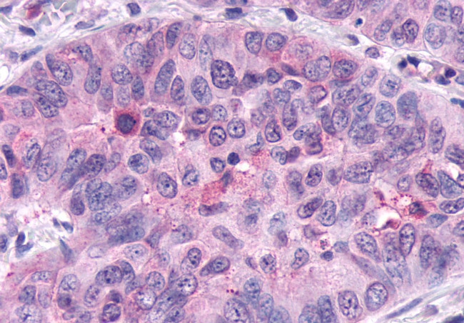 FZD5 Antibody in Immunohistochemistry (Paraffin) (IHC (P))