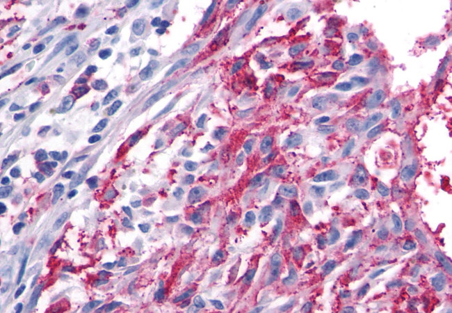 FZD5 Antibody in Immunohistochemistry (Paraffin) (IHC (P))