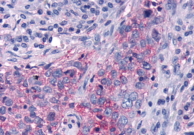 FZD5 Antibody in Immunohistochemistry (Paraffin) (IHC (P))