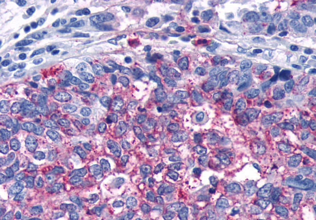 FZD5 Antibody in Immunohistochemistry (Paraffin) (IHC (P))