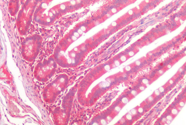 FZD7 Antibody in Immunohistochemistry (Paraffin) (IHC (P))