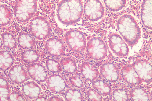 FZD7 Antibody in Immunohistochemistry (Paraffin) (IHC (P))