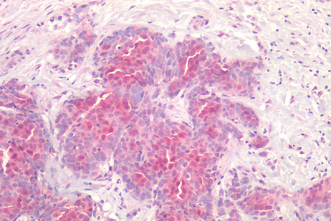 FZD7 Antibody in Immunohistochemistry (Paraffin) (IHC (P))