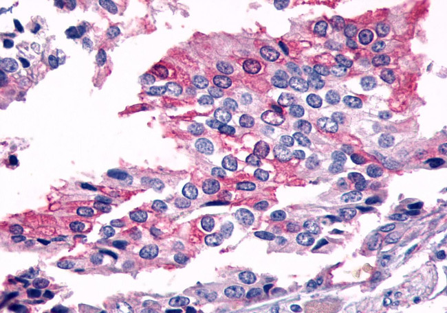 FZD7 Antibody in Immunohistochemistry (Paraffin) (IHC (P))