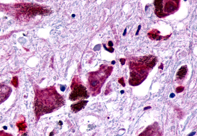 FZD8 Antibody in Immunohistochemistry (Paraffin) (IHC (P))