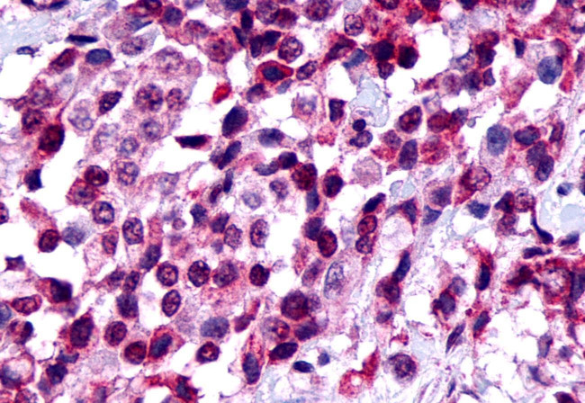 FZD8 Antibody in Immunohistochemistry (Paraffin) (IHC (P))