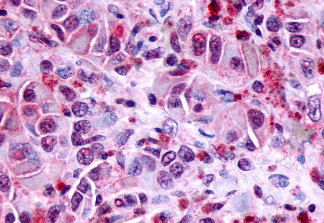 FZD8 Antibody in Immunohistochemistry (Paraffin) (IHC (P))