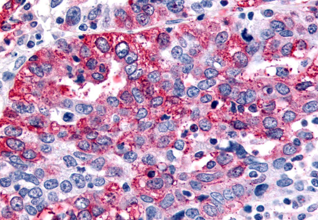 GABBR1 Antibody in Immunohistochemistry (Paraffin) (IHC (P))