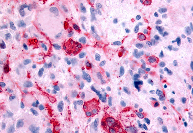 GABBR1 Antibody in Immunohistochemistry (Paraffin) (IHC (P))