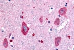 GABBR1 Antibody in Immunohistochemistry (Paraffin) (IHC (P))