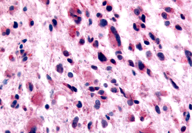 GABBR1 Antibody in Immunohistochemistry (Paraffin) (IHC (P))