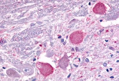 GALR2 Antibody in Immunohistochemistry (Paraffin) (IHC (P))