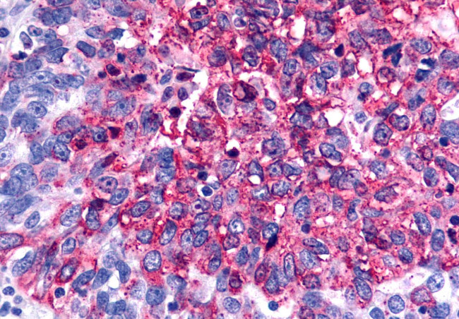 GALR2 Antibody in Immunohistochemistry (Paraffin) (IHC (P))