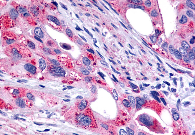 GALR2 Antibody in Immunohistochemistry (Paraffin) (IHC (P))