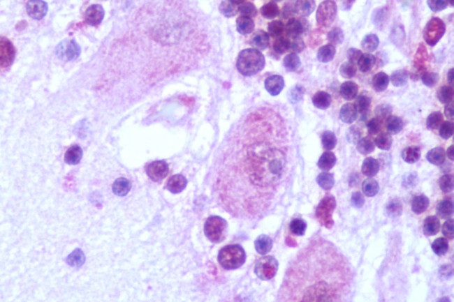 GALR2 Antibody in Immunohistochemistry (Paraffin) (IHC (P))