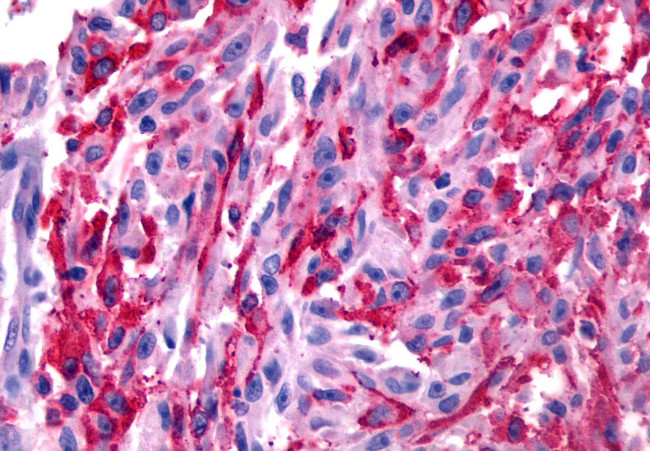 GALR2 Antibody in Immunohistochemistry (Paraffin) (IHC (P))