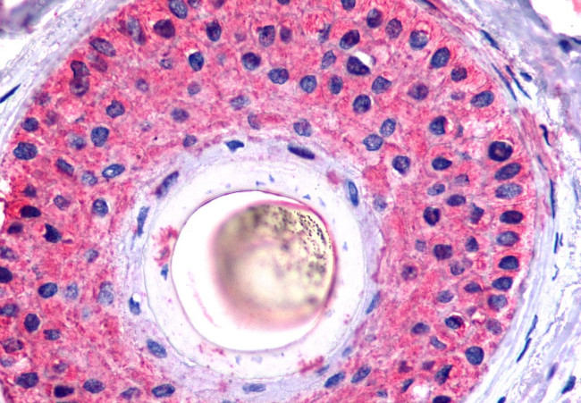 GALR2 Antibody in Immunohistochemistry (Paraffin) (IHC (P))