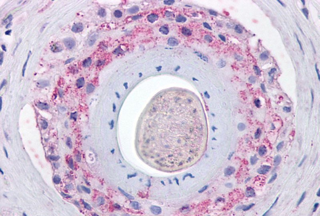 GHSR Antibody in Immunohistochemistry (Paraffin) (IHC (P))