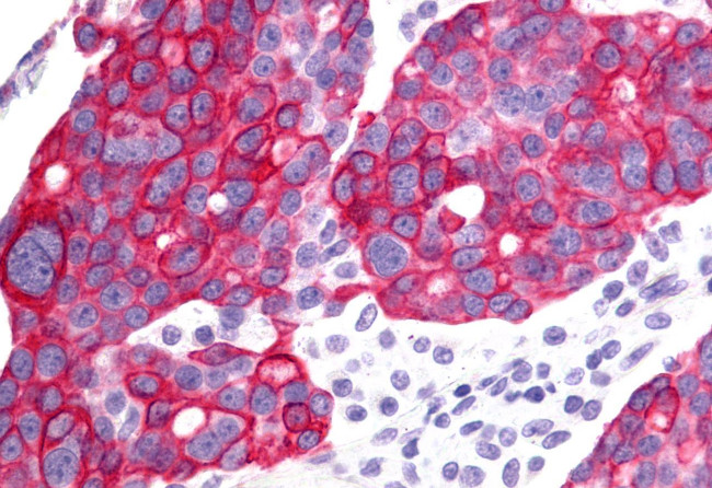 GHRHR Antibody in Immunohistochemistry (Paraffin) (IHC (P))