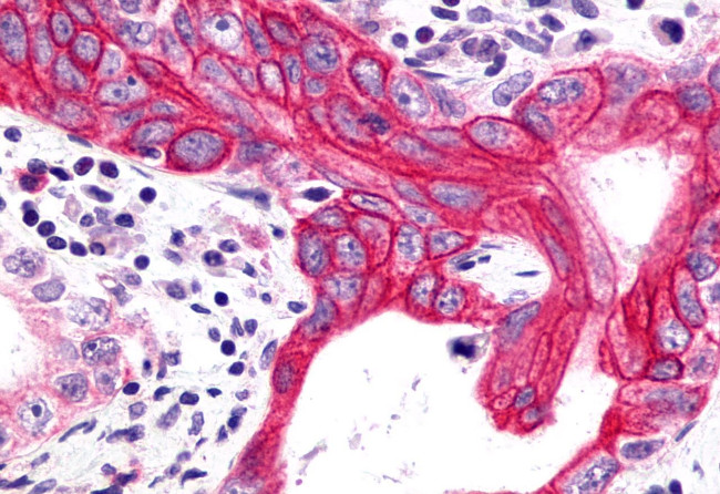 GHRHR Antibody in Immunohistochemistry (Paraffin) (IHC (P))