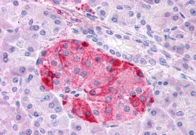 GIPR Antibody in Immunohistochemistry (Paraffin) (IHC (P))