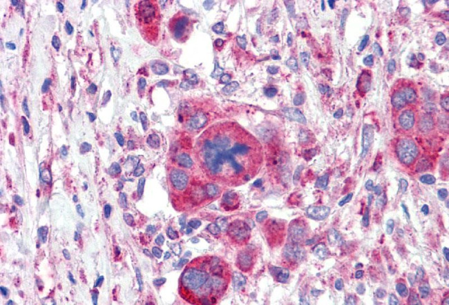 GLP1R Antibody in Immunohistochemistry (Paraffin) (IHC (P))