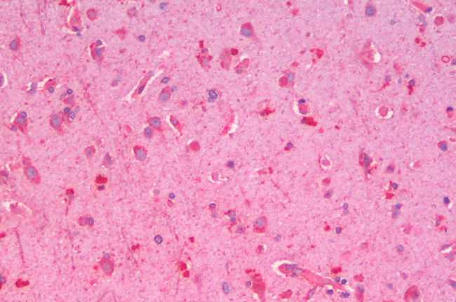 GLP1R Antibody in Immunohistochemistry (Paraffin) (IHC (P))