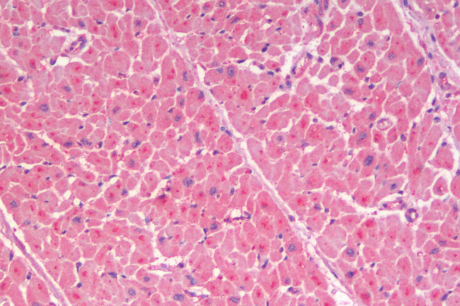 GLP1R Antibody in Immunohistochemistry (Paraffin) (IHC (P))