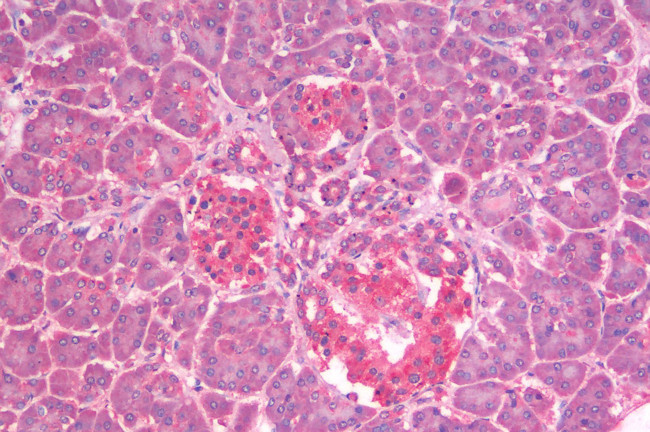 GLP1R Antibody in Immunohistochemistry (Paraffin) (IHC (P))