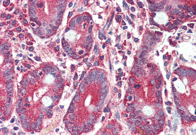 GLP2R Antibody in Immunohistochemistry (Paraffin) (IHC (P))