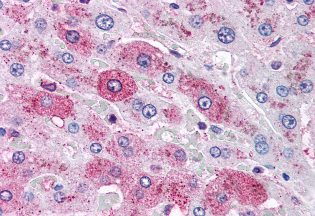 Glucagon Receptor Antibody in Immunohistochemistry (Paraffin) (IHC (P))