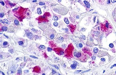 GnRHR Antibody in Immunohistochemistry (Paraffin) (IHC (P))