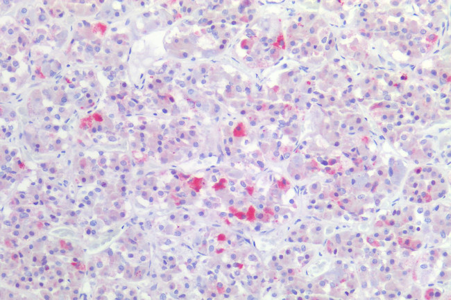 GnRHR Antibody in Immunohistochemistry (Paraffin) (IHC (P))