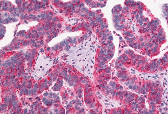 GPR1 Antibody in Immunohistochemistry (Paraffin) (IHC (P))