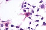 GPR1 Antibody in Immunocytochemistry (ICC/IF)