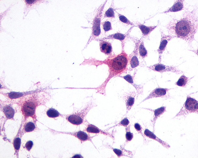 GPR1 Antibody in Immunocytochemistry (ICC/IF)