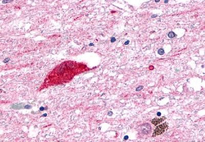 GPR1 Antibody in Immunohistochemistry (Paraffin) (IHC (P))