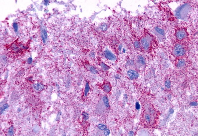 GPR101 Antibody in Immunohistochemistry (Paraffin) (IHC (P))