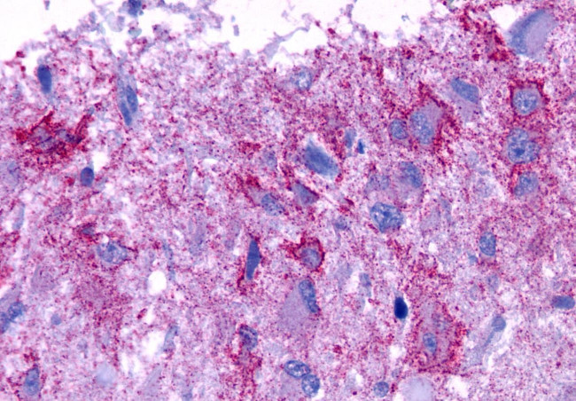 GPR101 Antibody in Immunohistochemistry (Paraffin) (IHC (P))