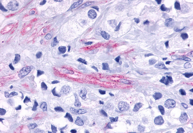 TEM5 Antibody in Immunohistochemistry (Paraffin) (IHC (P))