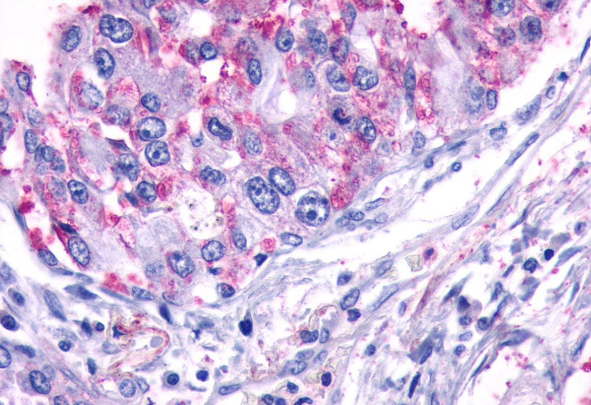 TEM5 Antibody in Immunohistochemistry (Paraffin) (IHC (P))