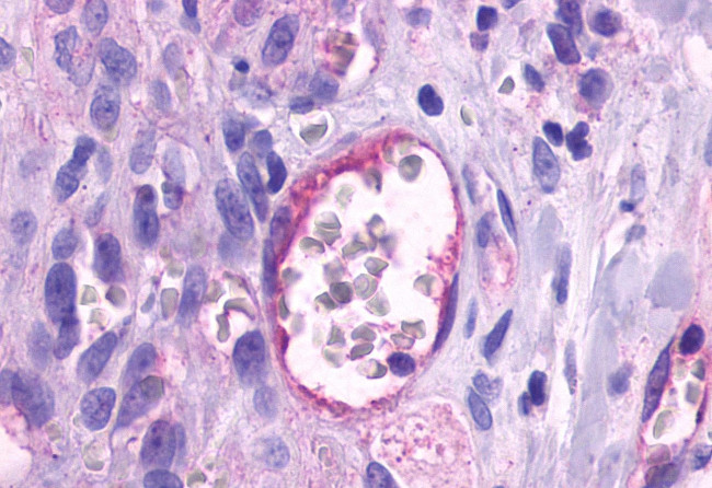 TEM5 Antibody in Immunohistochemistry (Paraffin) (IHC (P))