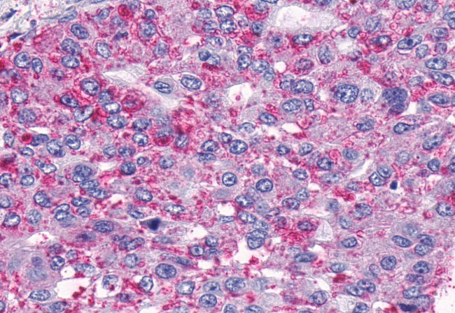 TEM5 Antibody in Immunohistochemistry (Paraffin) (IHC (P))