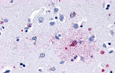 GPR139 Antibody in Immunohistochemistry (Paraffin) (IHC (P))