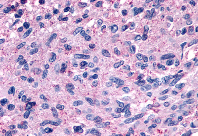 GPR139 Antibody in Immunohistochemistry (Paraffin) (IHC (P))