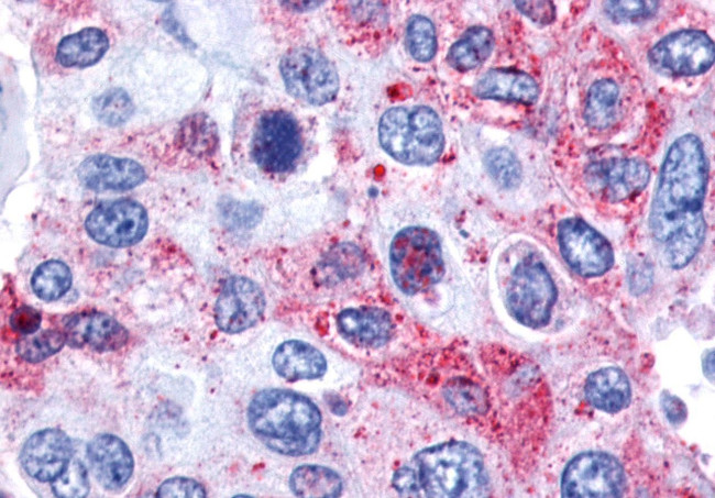 GPR139 Antibody in Immunohistochemistry (Paraffin) (IHC (P))