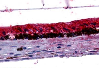 GPR143 Antibody in Immunohistochemistry (Paraffin) (IHC (P))