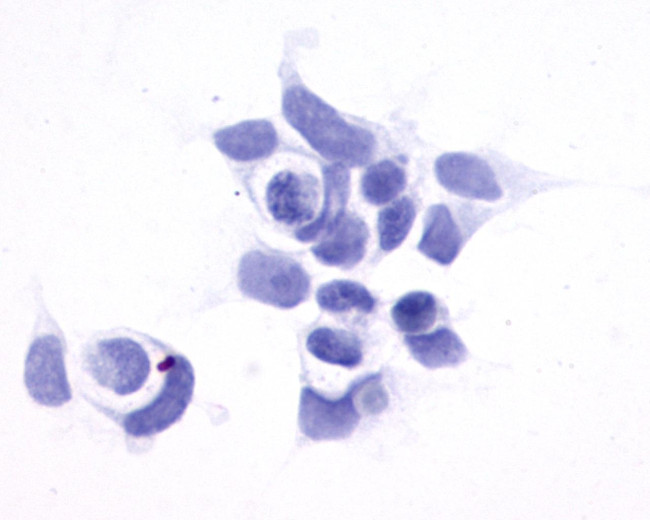 GPR161 Antibody in Immunocytochemistry (ICC/IF)